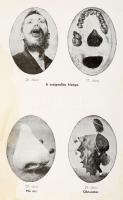 Popiel Dénes: A szájak és fogak egészségtana. Népszerű kiadás 33 ábrával. Bp., 1936. Dinkel Frigyes....