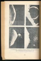 Dr. Czeizel Endre: Születésünk titkai. Bp., 1981, RTV-MInerva. Kiadói papírkötés, első kötéstáblán t...