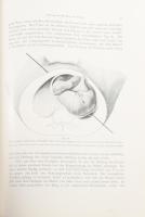 Bumm, Ernst: Grundriss zum Studium der Geburtshülfe. Wiesbaden, 1905, J. F. Bergmann, XI+(1)+787+(5)...