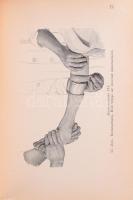 Zuckerkandl Ottó: A sebészeti műtéttan alapvonalai. Ford.: Dr. Illyés Géza. Orvosi kézi atlaszok VII...