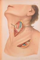 Zuckerkandl Ottó: A sebészeti műtéttan alapvonalai. Ford.: Dr. Illyés Géza. Orvosi kézi atlaszok VII...