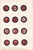 Feleky Hugó: 
A húgycső betegségeinek urethoskopiai kórjelzése és orvoslása. (Dedikált.)
Budapest,...