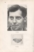 Wein Dezső: 
Az állkapocssérülések gyógyítása.
Budapest, 1921. Pápai Ernő Műintézete. II + 149 + [...