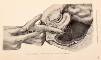 Tauffer Vilmos - Tóth István (szerk.): A nőgyógyászat kézikönyve. I. köt. Bp., 1917, Franklin-Társul...