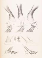 Barcsay Jenő: Művészeti anatómia. Rajzolta és a magyarázó szöveget írta: - - . Bp., 1953, Művelt Nép...