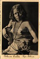 Colonia Eritrea, Tipo Bilena / Eritrean folklore (kis szakadás / small tear)