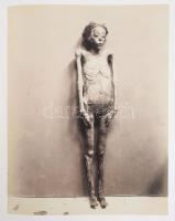 Der Körper der Photographie. Eine Welterzählung in Aufnahmen der Sammlung Herzog. Hrsg.: Dieter Bach...