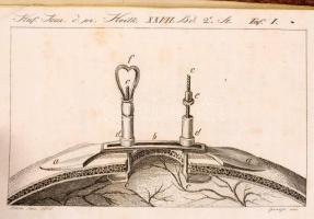 Hufeland Christoph Wilhelm: Neues Journal der practischen Arzneykunde und Wundarzneykunst 20. Band. ...