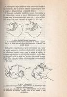 Gara Imre: 
Kardiovaszkuláris krízisek. Szerkesztette: Gara Imre. (Dedikált.)
Budapest, 1985. Medi...