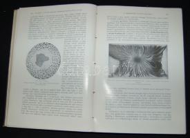 Schmaus: A kórbonctan alapvonalai I. kötet 410 nagyrészt színes ábrával. Bp., 1914 Franklin. Kissé s...