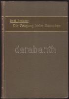 Rohleder: Zeigung beim Menschen - eine sexualphysiologische Studie aus der Praxis. Leipzig 1911, Georg Thieme