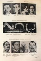 A család egészsége: Népszerű orvosi tájékoztató és tanácsadó. Szerk. Dr. Somogyi Béla. Szétnyitható ...