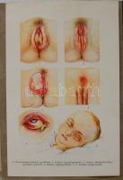 A család egészsége: Népszerű orvosi tájékoztató és tanácsadó. Szerk. Dr. Somogyi Béla. Szétnyitható ...