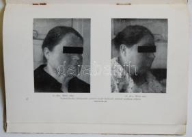 ~1930 Dr. Ehrenfeld Hugó: A szépítősebészetről, Bp., Novák Rudolf és Társa, papírkötés, a szerző 44 ...