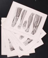 cca 1850/1880 6db anatómiai tábla, acél-, ill. rézmetszetek (egy sérült) / 
6 anatomical plates, ste...