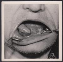 cca 1940-1950 Orvosi fotó, 9x9cm