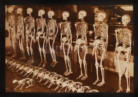1930-1940 Csontvázkollekció. "Wide World Photos" jelzéssel, a Pesti Napló archívumából (felületén törésnyomok, használtas állapotú) /  A Collection of Sceletons. "Copyright Wide World Photos" stamp on the verso (somewhat worn condition) 17x23cm