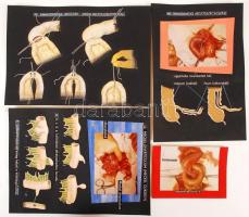 cca 1960 A Gyermek sebészet c. diafilm eredeti, komplett, fényképezett és montázsolt kockái, a gyárt...