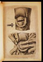 Lejars Félix: Sürgős sebészeti műtétek. Bp., 1906, Magyar Orvosi Könyvkiadó Társulat. (A Magyar Orvo...